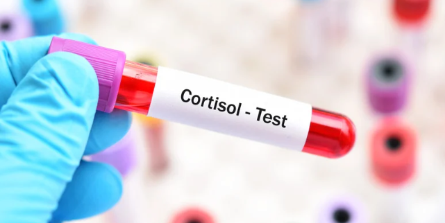 niski kortyzol i wysokie stężenie kortyzolu (jego stężenie) - ampułka do testu kortyzolu